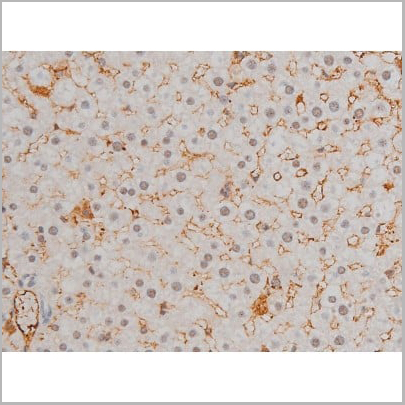 product-image-AAA31019_IHC14.jpg