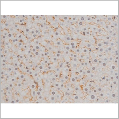 product-image-AAA31019_IHC15.jpg