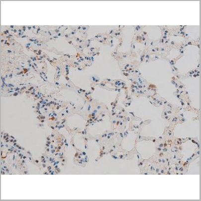 product-image-AAA31019_IHC16.jpg