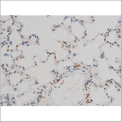 product-image-AAA31019_IHC17.jpg