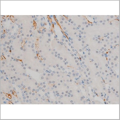 product-image-AAA31019_IHC19.jpg