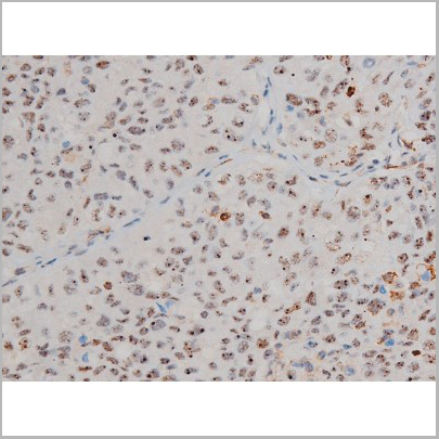 product-image-AAA31019_IHC3.jpg