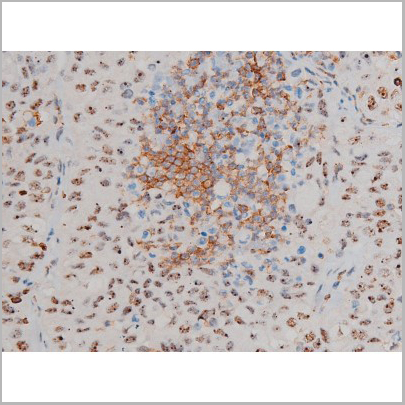 product-image-AAA31019_IHC4.jpg
