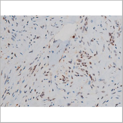 product-image-AAA31019_IHC5.jpg