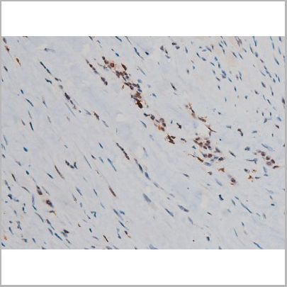 product-image-AAA31019_IHC6.jpg