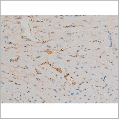 product-image-AAA31019_IHC7.jpg