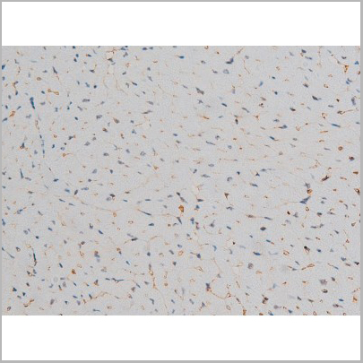 product-image-AAA31019_IHC8.jpg