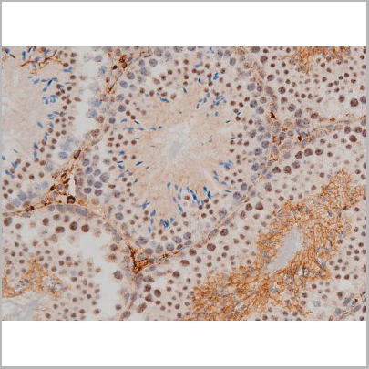 product-image-AAA31019_IHC9.jpg