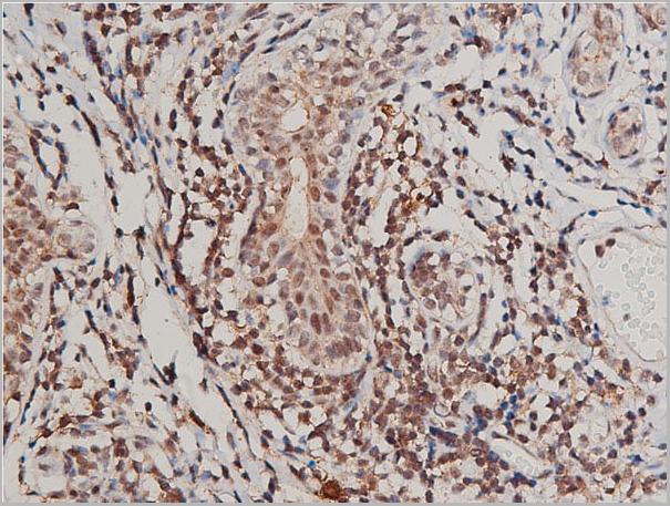 product-image-AAA31020_IHC5.jpg