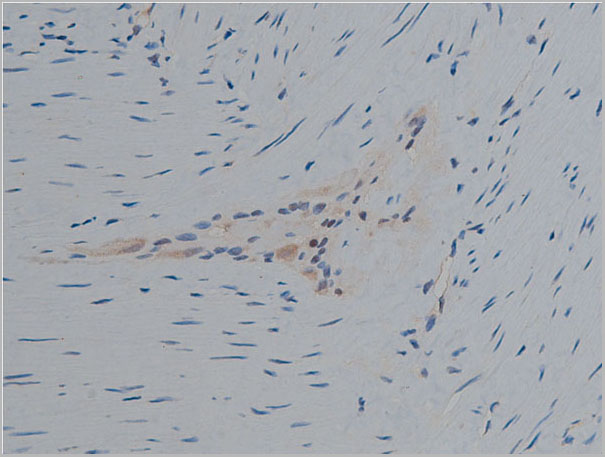 product-image-AAA31021_IHC3.jpg