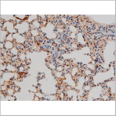 product-image-AAA31022_IHC11.jpg