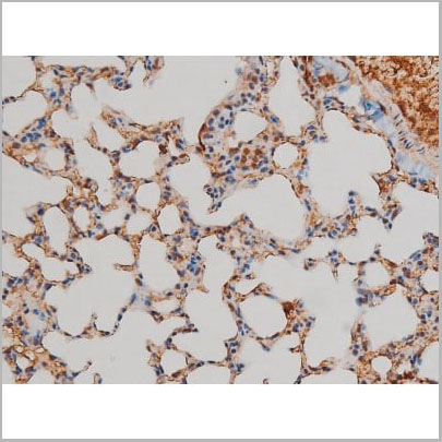 product-image-AAA31022_IHC12.jpg
