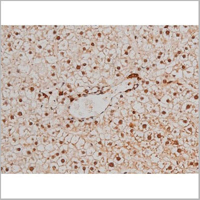 product-image-AAA31022_IHC13.jpg