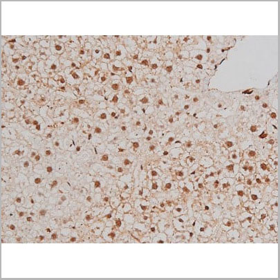 product-image-AAA31022_IHC14.jpg