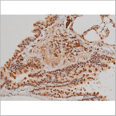 product-image-AAA31022_IHC15.jpg