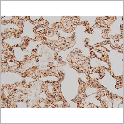 product-image-AAA31022_IHC16.jpg