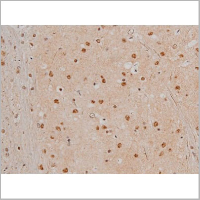 product-image-AAA31022_IHC17.jpg