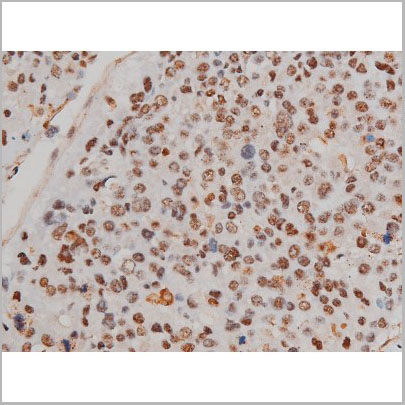 product-image-AAA31022_IHC2.jpg