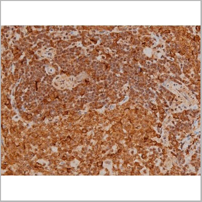 product-image-AAA31022_IHC20.jpg