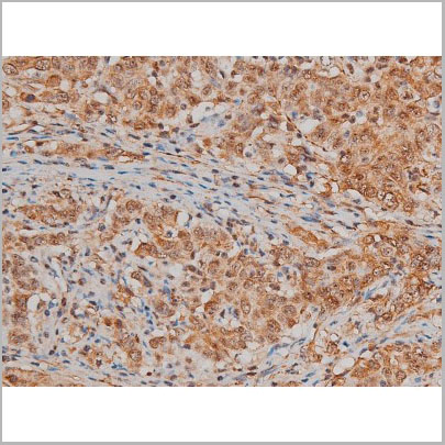 product-image-AAA31022_IHC3.jpg