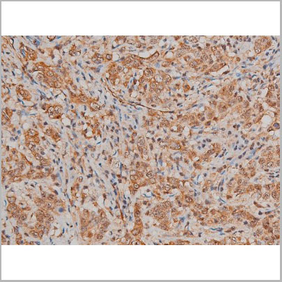 product-image-AAA31022_IHC4.jpg