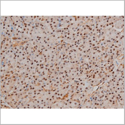 product-image-AAA31022_IHC5.jpg