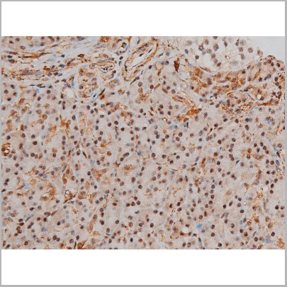 product-image-AAA31022_IHC6.jpg