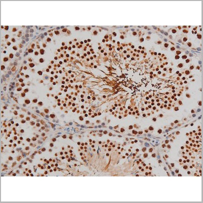 product-image-AAA31022_IHC7.jpg
