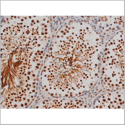 product-image-AAA31022_IHC8.jpg