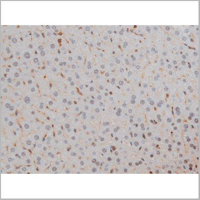 product-image-AAA31022_IHC9.jpg