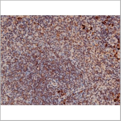 product-image-AAA31023_IHC10.jpg