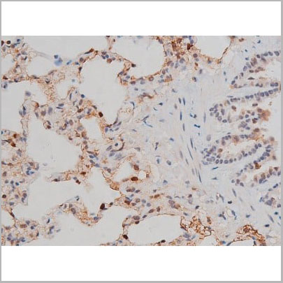 product-image-AAA31023_IHC12.jpg