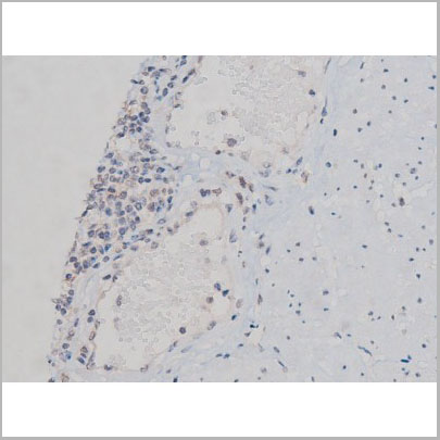 product-image-AAA31023_IHC5.jpg