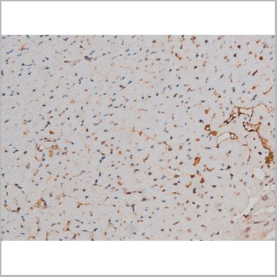 product-image-AAA31023_IHC6.jpg