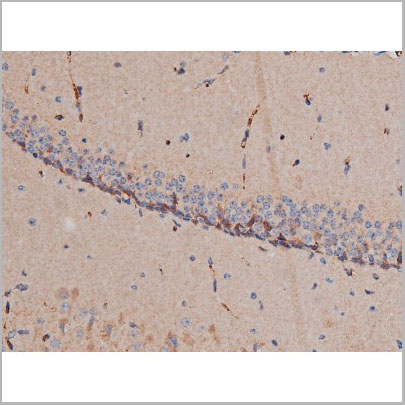 product-image-AAA31023_IHC8.jpg
