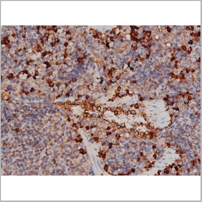 product-image-AAA31023_IHC9.jpg