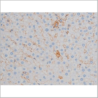 product-image-AAA31024_IHC11.jpg