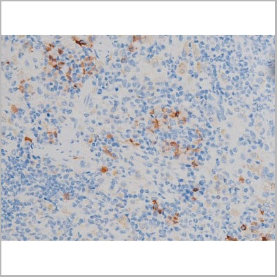 product-image-AAA31024_IHC12.jpg