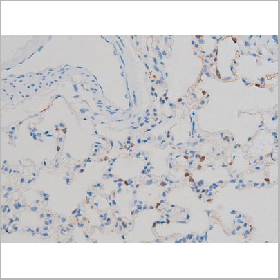 product-image-AAA31024_IHC13.jpg