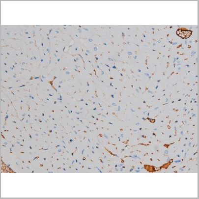 product-image-AAA31024_IHC3.jpg