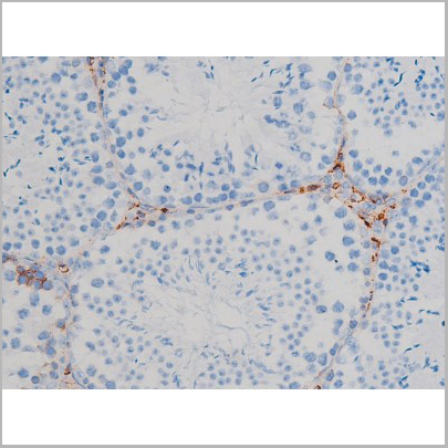product-image-AAA31024_IHC4.jpg