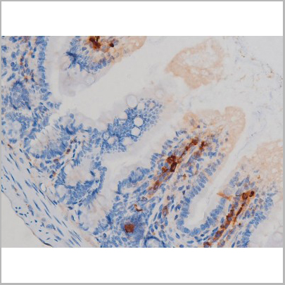 product-image-AAA31024_IHC6.jpg