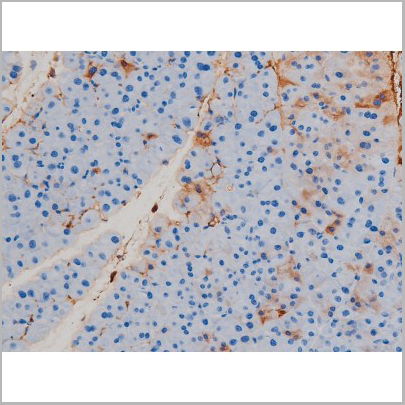 product-image-AAA31024_IHC7.jpg