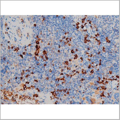 product-image-AAA31024_IHC8.jpg