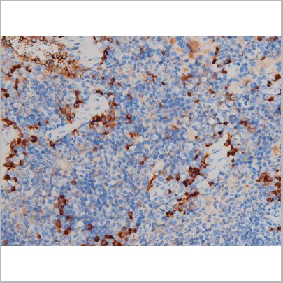 product-image-AAA31024_IHC9.jpg