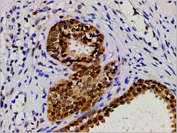 product-image-AAA31025_IHC11.jpg