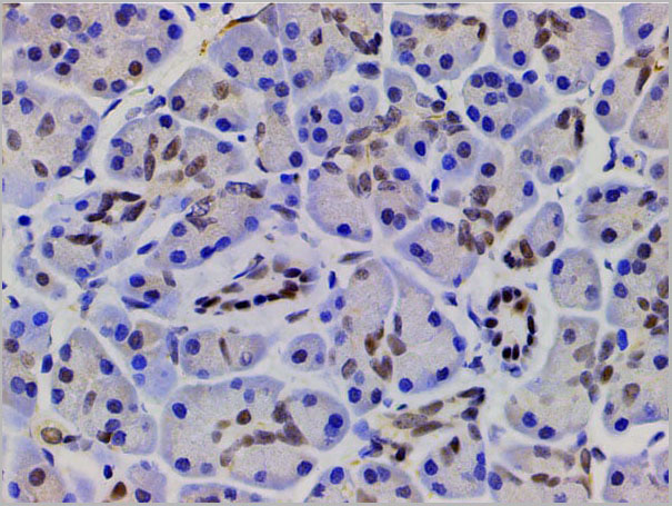 product-image-AAA31025_IHC12.jpg