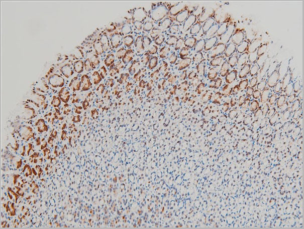product-image-AAA31025_IHC17.jpg