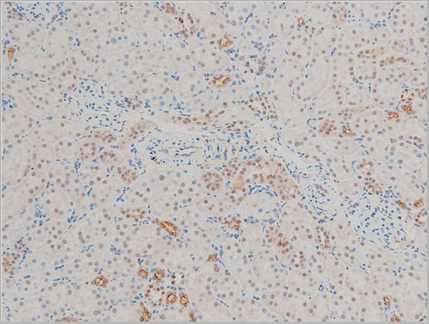 product-image-AAA31025_IHC18.jpg