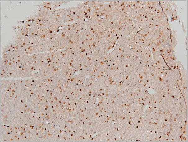 product-image-AAA31025_IHC19.jpg